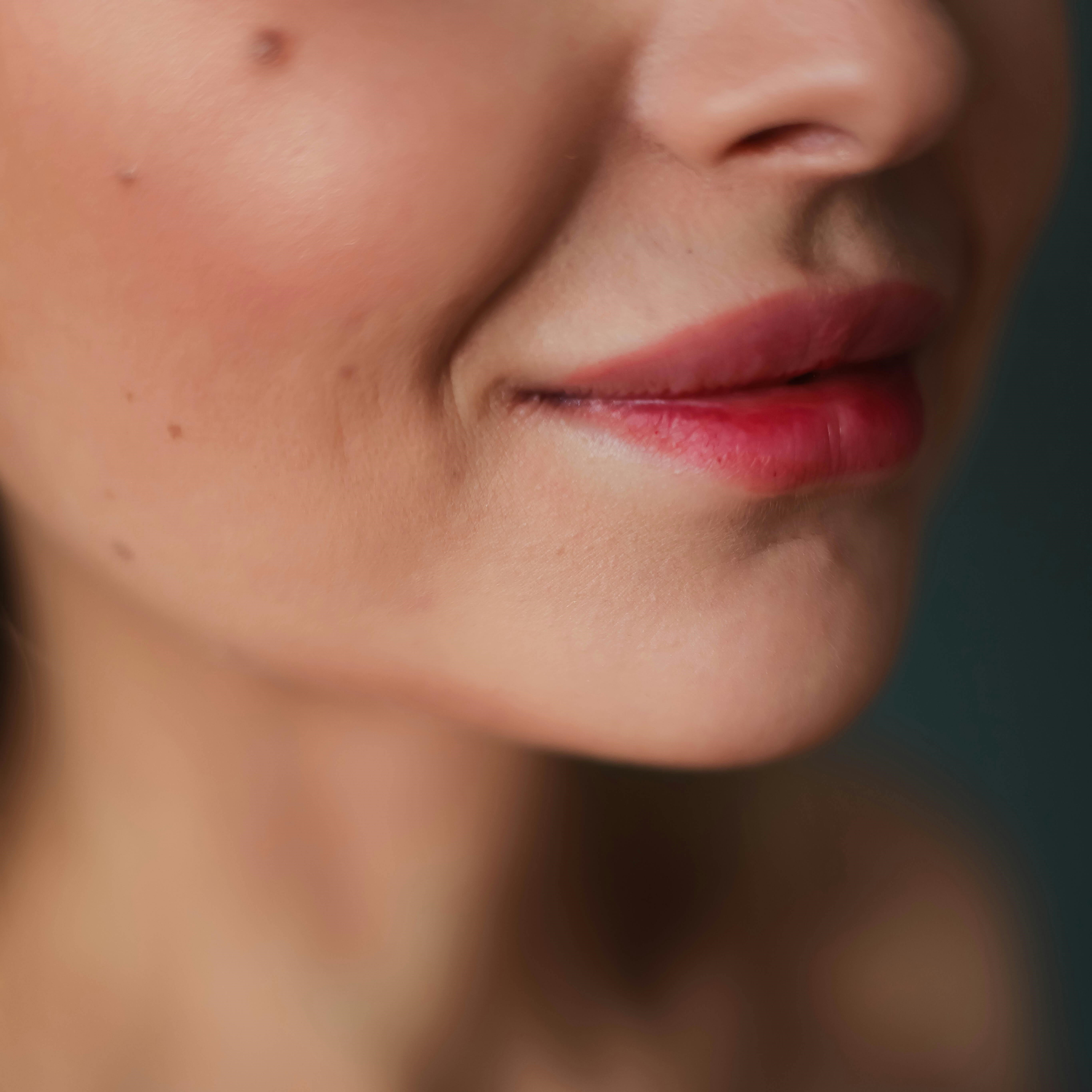 Armonización orofacial